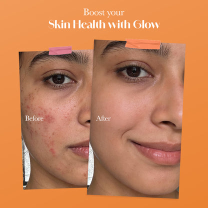 Glow Glutathione Tablets for Skin Brightening – Orange Flavour, Pack of 1